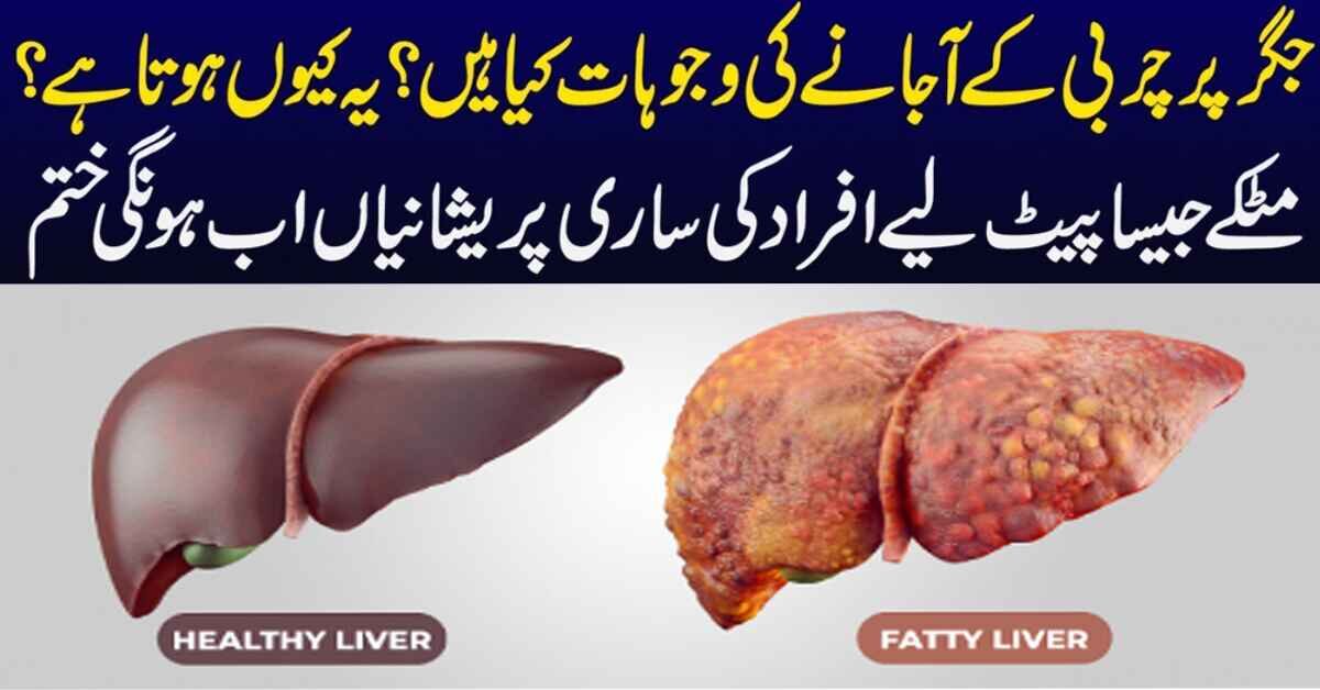 fatty liver